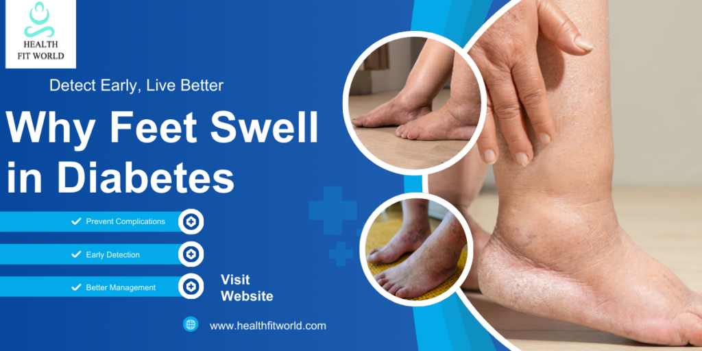 The Shocking Truth Behind Why Feet Swell in Diabetes