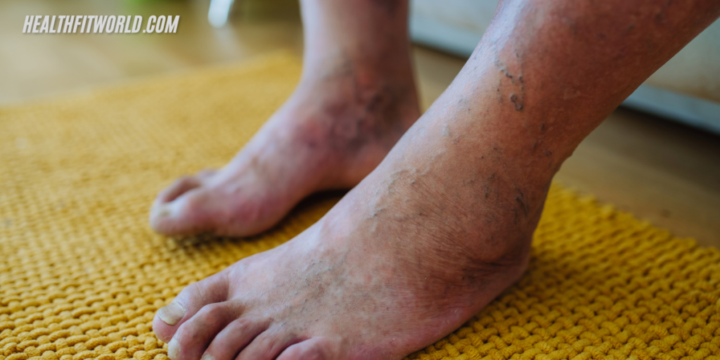 Discolored Feet? The Shocking Causes You Must Know!